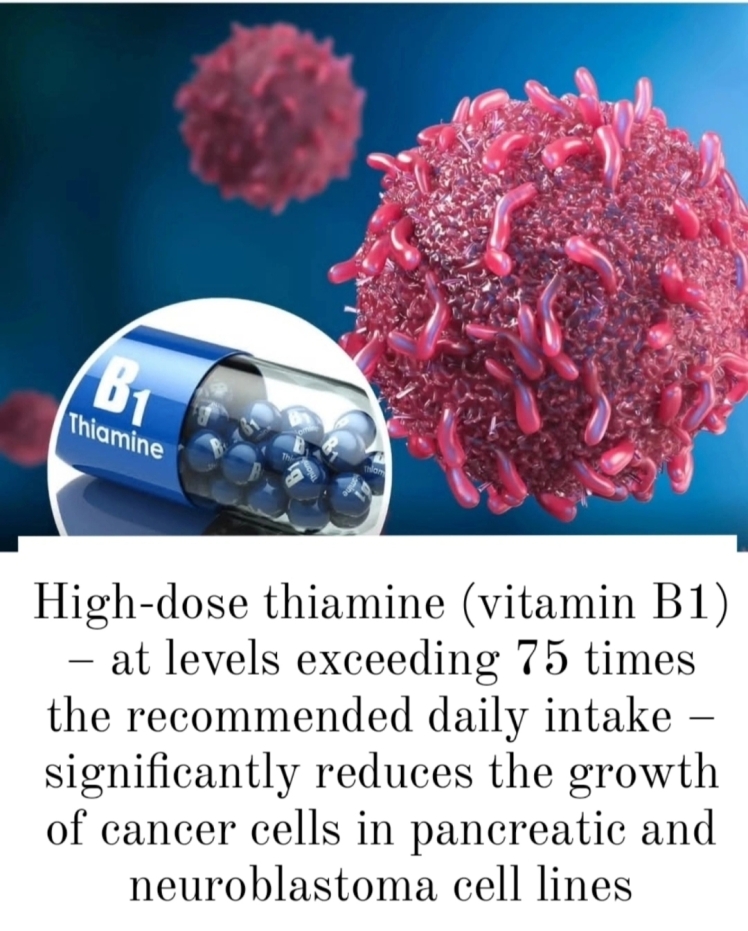 High-Dose Thiamine Shows Promising Anti-Cancer Effects in Pancreatic and Neuroblastoma Cell Lines
