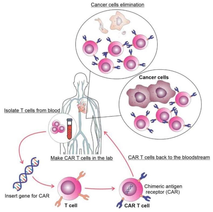 Patients with CLL are now benefiting from innovative treatments such as CAR T-cell therapySusan Hau