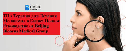 TILs Терапия для Лечения Меланомы в Китае: Полное Руководство от Beijing Bioocus Medical Group