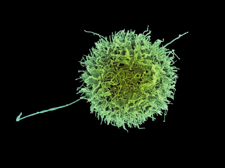 Leading Hospitals Driving the NK Cell Therapy Revolution in China