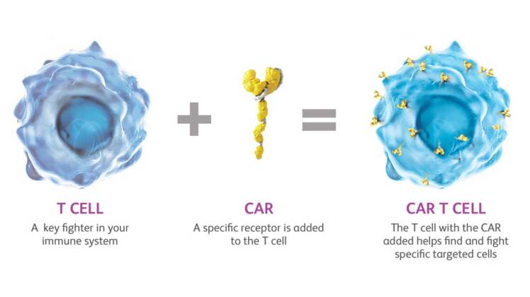 Is CAR T-Cell Therapy Possibly a ‘Cure’ for Leukemia?